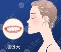 地包天自我矯正方法有哪些？什么時(shí)候做矯正好？