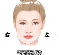 大小臉怎么改善？下面幾種方式那種比較推薦呢？