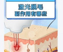 激光VS冰點(diǎn)脫毛：誰才是毛躁克星？