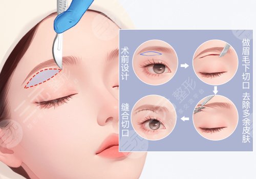 貴陽第一人民醫(yī)院提眉