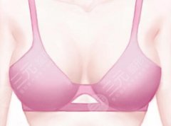 德國寶儷假體型號咋樣？3大核心維度決定型號適配性