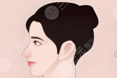 自體脂肪墊下巴有后遺癥嗎？過(guò)來(lái)人說(shuō)清3個(gè)常見問(wèn)題，附恢復(fù)時(shí)間表