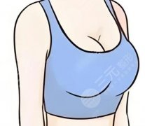 切副乳手術需要住院嗎？住不住院全看這2點，很多人白擔心了