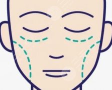 大連脂肪填充哪里好？5家口碑醫(yī)院實(shí)測(cè)！公立私立優(yōu)缺點(diǎn)全扒