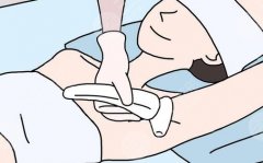 冰點脫毛和激光脫毛的區(qū)別有哪些？項目區(qū)別揭曉|看完這篇不踩坑