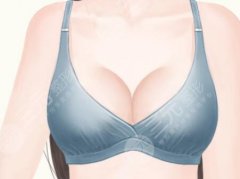 蜜桃豐胸手術(shù)怎么做的？全流程及方案對比揭曉啦