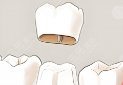 矯正深覆合會改變臉型嗎？看3個真實案例來了解情況