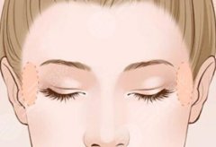 糾結(jié)歐洲之星緊致還是3D生物？普通人看完不踩坑的醫(yī)美干貨