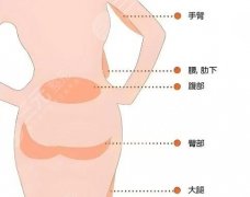 做蜜桃臀建議用脂肪填充嗎？內(nèi)行人給你扒明白