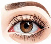 切眉后別瞎折騰！這些注意事項(xiàng)能讓你恢復(fù)少走80%彎路