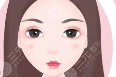 豐唇能改變唇形嗎？看完這篇不踩坑啦