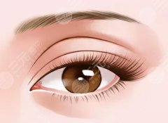 做內(nèi)眼角修復(fù)一個(gè)月眼淚多正常嗎？產(chǎn)生眼淚原因_護(hù)理方法精選