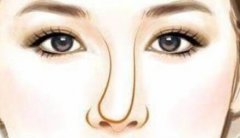 鼻翼縮小手術(shù)大概費(fèi)用？?jī)?nèi)行人曝3大花錢(qián)點(diǎn)，附各城市報(bào)價(jià)表