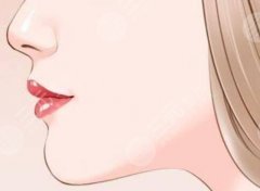 鼻基底凹陷用什么填充最好？3種填充方式實(shí)測(cè)對(duì)比|看完再也不踩坑