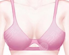 包膜攣縮一般多久出現(xiàn)？這些階段要盯緊