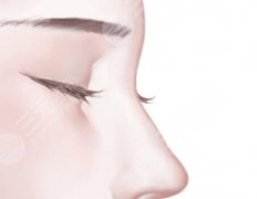 韓國(guó)韓式生科硅膠怎么樣？?jī)?nèi)附醫(yī)生實(shí)測(cè)數(shù)據(jù)|趕緊看吧