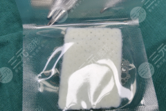 ADM生物補(bǔ)片有用嗎？看完這篇_不用再問醫(yī)生“有用嗎”