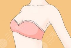 乳頭漂紅恢復(fù)需要多久？過來人嘮這些小事比時(shí)間本身更關(guān)鍵