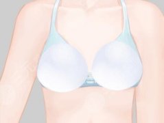 中凸假體和高凸假體的區(qū)別有哪些？從胸型到觸感全說(shuō)透啦