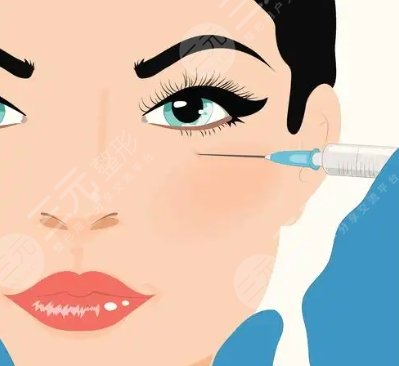 玻尿酸注射 
