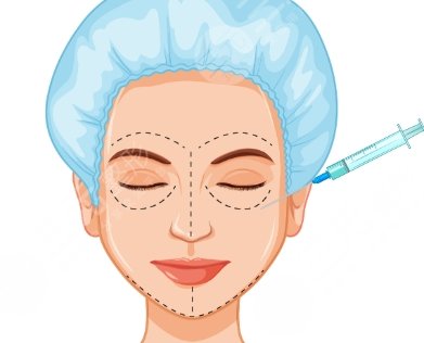 注射玻尿酸
