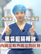 眶隔釋放內(nèi)固定和外固定哪個好？沒有最好，只有最適配