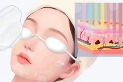 激光除皺有后遺癥嗎？全面解析與實(shí)用指南