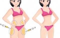 大腿抽脂和小腿抽脂可以一起做嗎？一次搞清聯(lián)合抽脂的價(jià)、人、風(fēng)險(xiǎn)