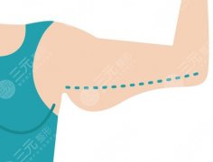 手臂抽脂和腰部抽脂有危險(xiǎn)嗎會(huì)疼嗎？真能把“拜拜肉”和“游泳圈”一次搞定？