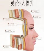 英倫大提升效果好嗎？術(shù)后15天真實(shí)記錄：我的臉發(fā)生了什么變化