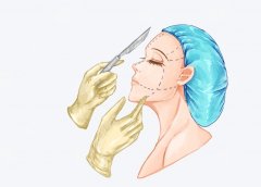 顴弓內(nèi)推和下頜角截骨哪個(gè)更危險(xiǎn)？面雕雙煞，安全排行榜出爐