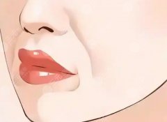 做酒窩可以改善法令紋嗎？酒窩+法令紋？別急著沖，先看完這篇