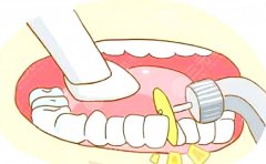 齊魯醫(yī)院正頜手術(shù)多少錢(qián)？怕貴？先看完這篇再?zèng)Q定