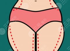 大腿抽脂和大腿環(huán)吸有什么區(qū)別？網(wǎng)友不懂的大腿環(huán)吸秘密，今天一次講透