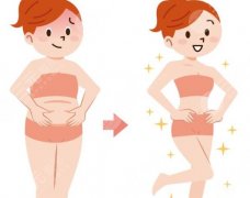 腹壁三件套是什么？?jī)r(jià)格、流程、恢復(fù)一次說(shuō)清，別再到處搜碎片信息