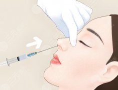 做自體脂肪隆鼻多久消腫？怕腫星人看過來，脂肪隆鼻恢復(fù)日歷來了