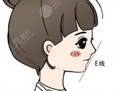 下巴后縮正頜手術(shù)怎么做的？從面診到拆板：下巴后縮手術(shù)180天實錄