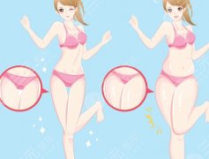 水動力吸脂和手術(shù)吸脂有什么區(qū)別？誰更適合水動力？誰只能選傳統(tǒng)刀？