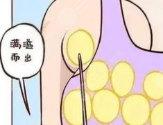 做副乳吸脂后應(yīng)注意事項(xiàng),錢(qián)花在刀口還是刀把？看完不懵
