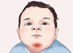 膠原蛋白墊下巴危害，醫(yī)美小白最容易踩的坑，疼三天，悔三年？