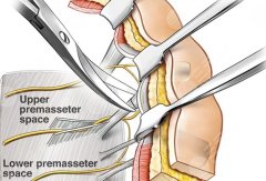 大腿做拉皮手術(shù)多少錢(qián)?。啃星楸?滿(mǎn)意度打分，一次看夠