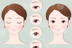 贛州第一附屬醫(yī)院割雙眼皮多少錢(qián)？費(fèi)用低至5497元起~