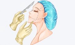 上海時(shí)光整形頜面好不好？下頜角、下巴、顴骨磨骨案例與口碑大曝光