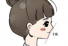 頦成型和正頜手術(shù)什么區(qū)別？頦成型 vs 正頜手術(shù)的核心區(qū)別與選擇思路解析