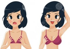 華西醫(yī)院隆胸掛什么科？流程、科室選擇和術(shù)前準(zhǔn)備步驟詳解