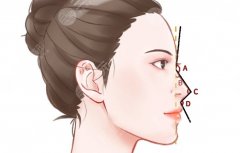 北京哪家鼻部整形好？口碑較好的醫(yī)院名單與各自擅長(zhǎng)風(fēng)格整理