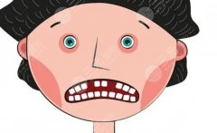 北京健?？谇环N植牙怎么樣？適合人群、優(yōu)劣勢(shì)與常見(jiàn)疑問(wèn)集中回答