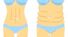 胃包吸脂有什么副作用？可能出現(xiàn)的副作用與風(fēng)險，一篇講清