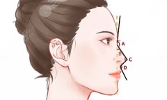 鼻部綜合整形的價(jià)格表，一份實(shí)用的鼻部綜合整形費(fèi)用參考清單