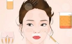 八大處脂肪填充痘坑，改善程度、維持時(shí)間及典型案例解析